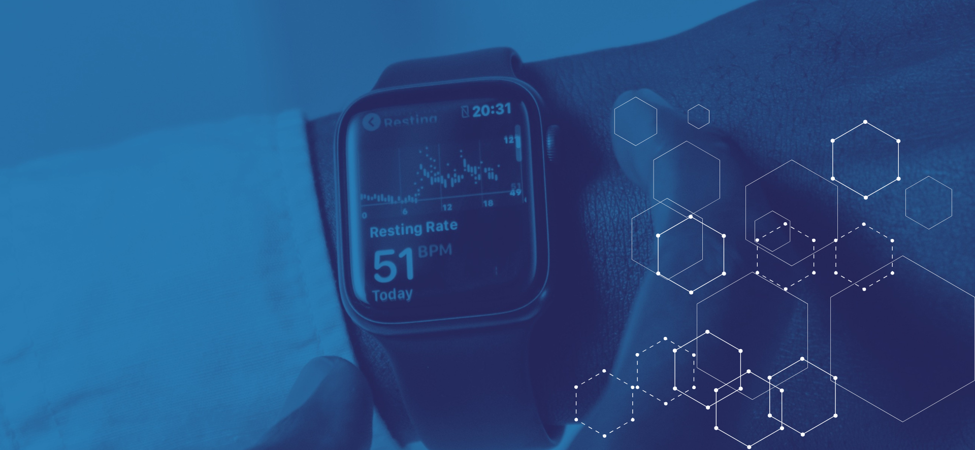 Remote Patient Monitoring Remote Patient Monitoring